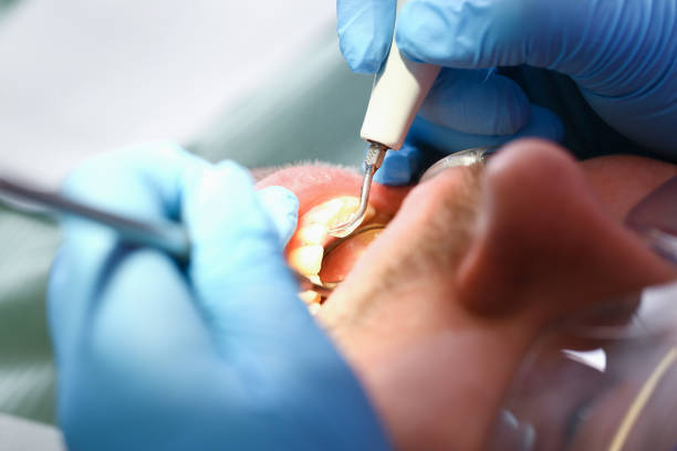 Best Teeth Whitening  in North Industry, OH