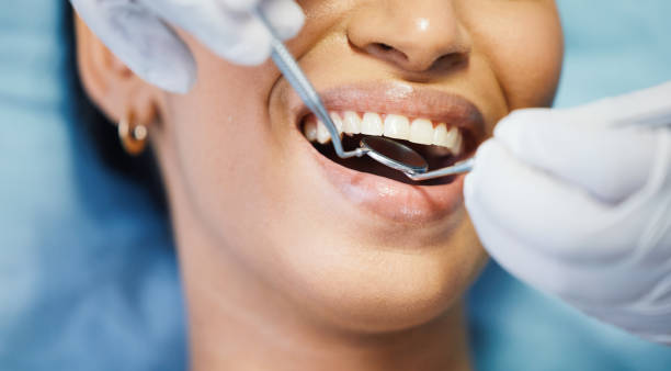 Best Emergency Gum Pain Relief  in North Industry, OH